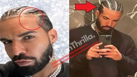 are drakes braids fake